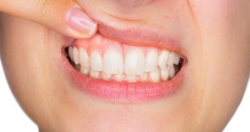 Latticini: quanti benefici per una bocca sana